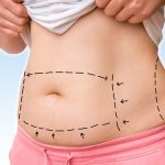 LIPOLYSIS AND REGIONAL SLIMMING