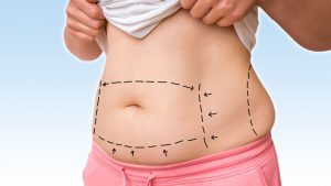 LIPOLYSIS AND REGIONAL SLIMMING